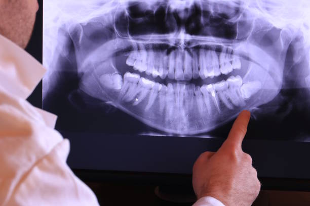 Best Emergency Treatment for Toothache in Fairview Shores, FL